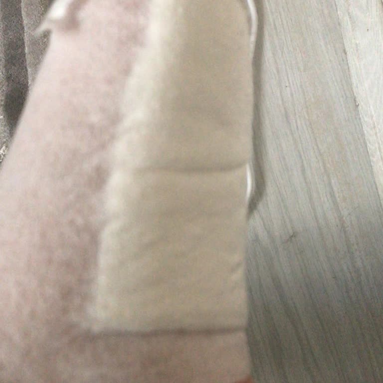 Mağazada Çivili Alarm Parçası Nedeniyle Yaralandım, Yardım Alamadım
