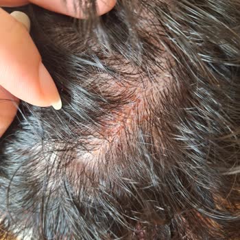 Ambalaj Değişikliği Sonrası Şampuan Cildimde Sorun Yarattı