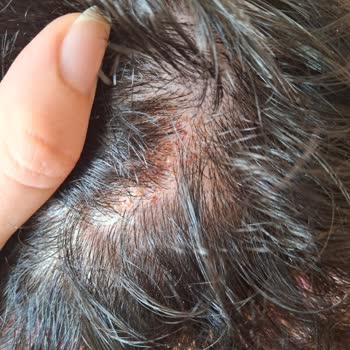 Ambalaj Değişikliği Sonrası Şampuan Cildimde Sorun Yarattı