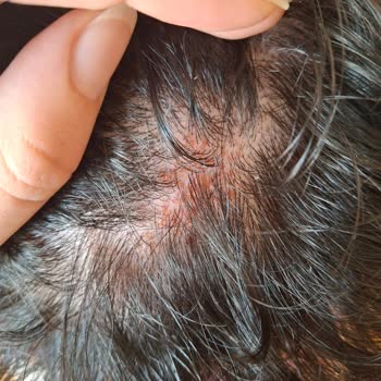 Ambalaj Değişikliği Sonrası Şampuan Cildimde Sorun Yarattı