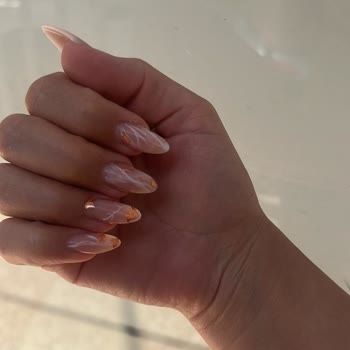 Hijyen Sorunu Ve Yetersiz Hizmet Nedeniyle Memnuniyetsizlik