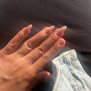 Hijyen Sorunu Ve Yetersiz Hizmet Nedeniyle Memnuniyetsizlik