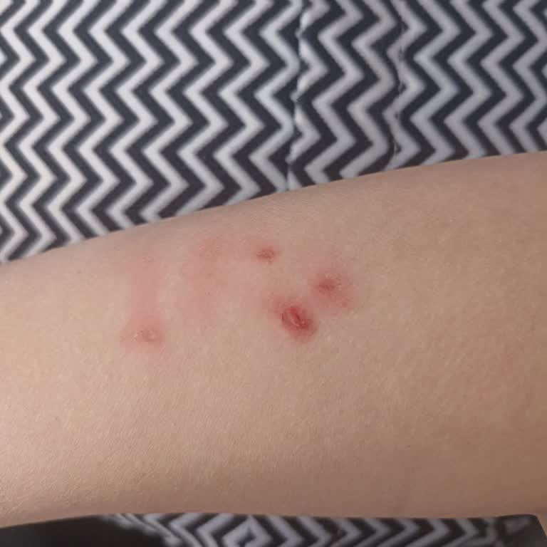 Okulda Maruz Kalınan Fiziksel Şiddet Ve Yetersiz Yönetim Müdahalesi