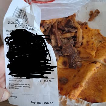 Alerji Uyarısı Dikkate Alınmadı, Yanık Ve Yağlı Ürün Teslim Edildi