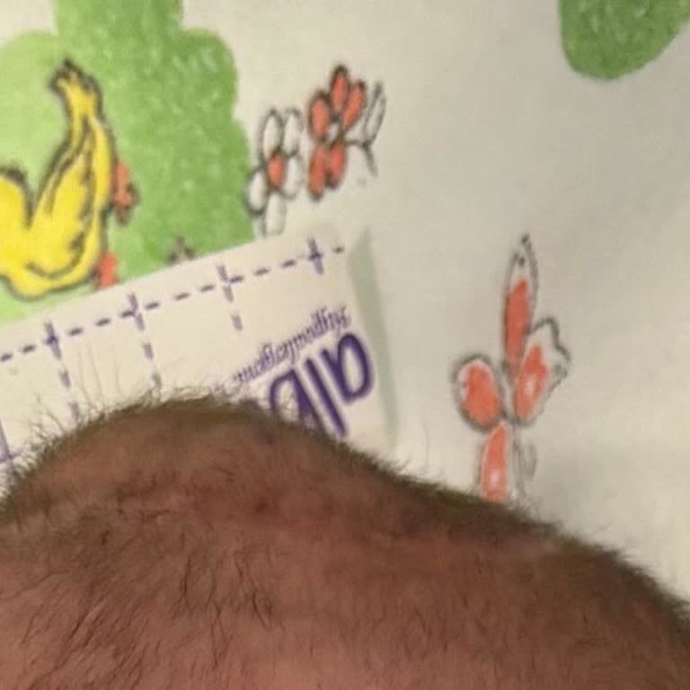 Bilkent Şehir Hastanesi'nde Yoğun Bakımda Yetersiz Hizmet Ve İletişim Sorunları