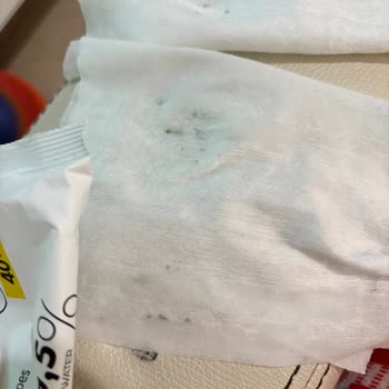 Bebek Islak Mendilinden Küf Çıkması Güvenimi Sarstı