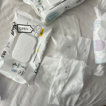 Küflü Islak Mendil Satışı Ve Sağlık Güvenliği Endişesi