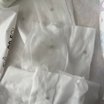 Küflü Islak Mendil Satışı Ve Sağlık Güvenliği Endişesi