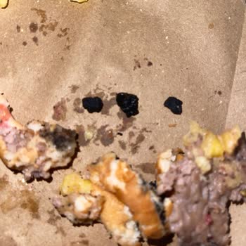 Hamburgerin İçinden Taş Çıkması Nedeniyle Dişim Kırılıyordu!