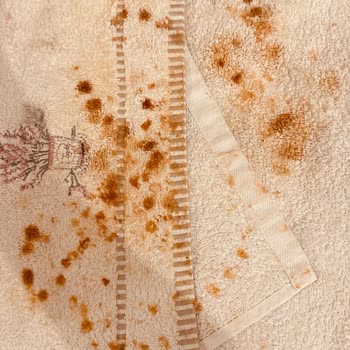 Yeni Alınan Ütüde De Sarı Su Ve Kireç Sorunu Yaşıyorum