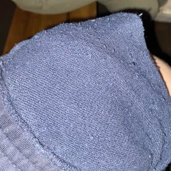 Mavi'den Alınan Eşofman Altlarında Hızlı Tüylenme Sorunu