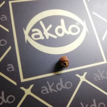 Kadayıfın İçinden Çıkan Sert Cisim Diş Kırdı