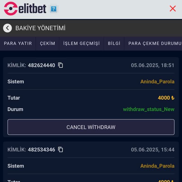 Çekim İşlemlerinde Uzun Süreli Bekletilme Ve Yetersiz Destek