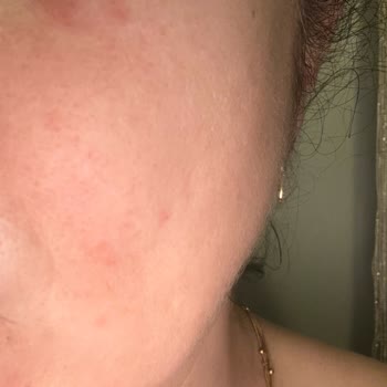 Tshop Aldığım Ürünler Bozuk Ve Tarihi Geçmiş Çıktı, Cildimde Sorun Oluştu