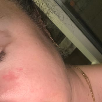 Tshop Aldığım Ürünler Bozuk Ve Tarihi Geçmiş Çıktı, Cildimde Sorun Oluştu