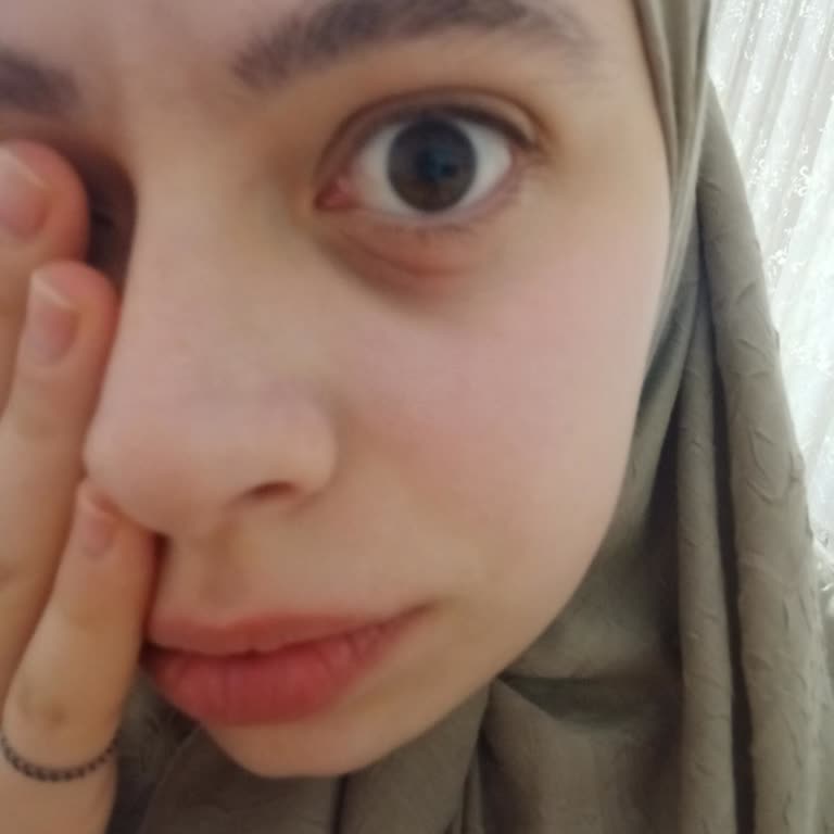 Göz Altı Kremi Ve Serum Ciltte Şişlik Ve Kızarıklık Yaptı