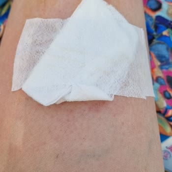 Orka World Hotel & Aquapark Su Parkında Güvenlik Zafiyeti Ve İlgisiz Yaklaşım