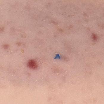 Namet Hindi Füme Ürününde Mavi Plastik Benzeri Yabancı Madde Şikayeti