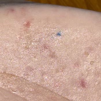 Namet Hindi Füme Ürününde Mavi Plastik Benzeri Yabancı Madde Şikayeti