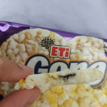 Eti Gong'un İçinden Yabancı Cisim Çıktı, Güvenim Sarsıldı