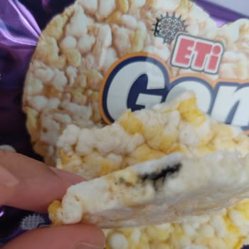 Eti Gong'un İçinden Yabancı Cisim Çıktı, Güvenim Sarsıldı