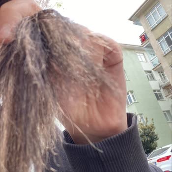 Saç Boyama Sonrası Ciddi Zarar Ve Hayal Kırıklığı