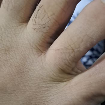 Tek Giyişte Ayaklarıma Zarar Veren Ayakkabı İçin Değişim Talebi