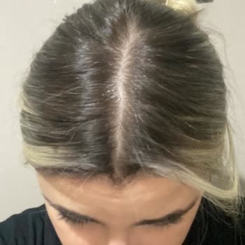 Saç Renginde Beklenmeyen Sonuç Ve Mağduriyet Yaşadım