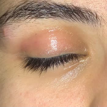 Watsons'tan Aldığım Far Gözümde Şiddetli Alerji Yaptı