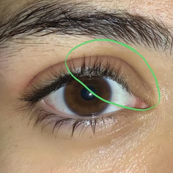 Watsons'tan Aldığım Far Gözümde Şiddetli Alerji Yaptı