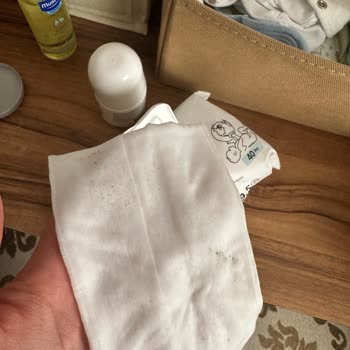 Yenidoğan Islak Mendilde Küf Ve Siyah İzler Hayal Kırıklığı Yarattı