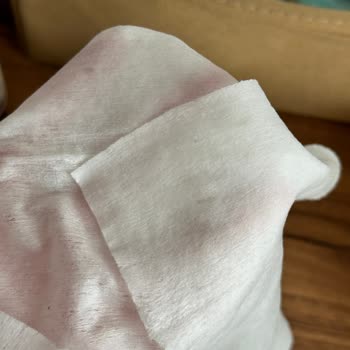 Yenidoğan Islak Mendilde Küf Ve Siyah İzler Hayal Kırıklığı Yarattı