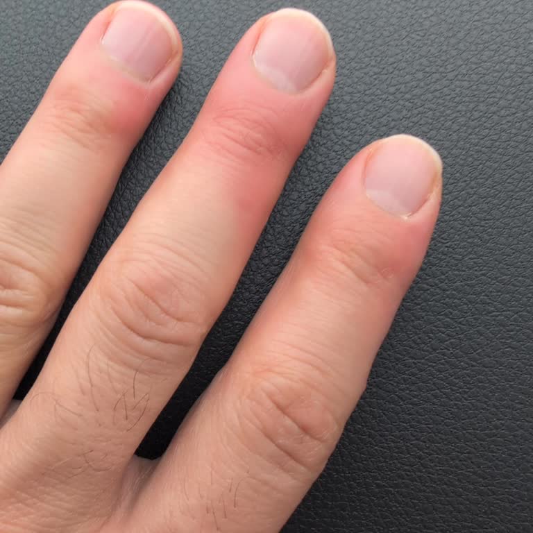 Kahve Dünyası'ndan Alınan Sıcak Kahve Bardak Ve Kapağı Elimi Yaktı