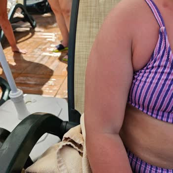 Sebamed Güneş Spreyi Çocuklarımı Koruyamadı, Tatilimiz Zehir Oldu