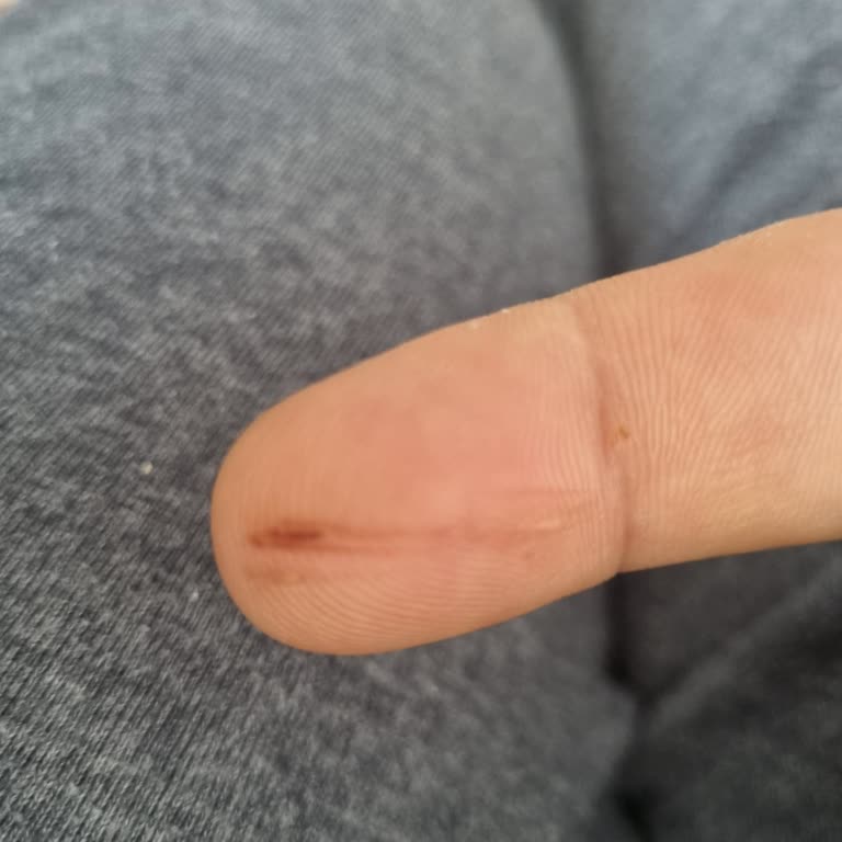 Karaca Gusto Bıçağının Sırtı Parmağımı Kesiyor Çözüm Bulamıyorum