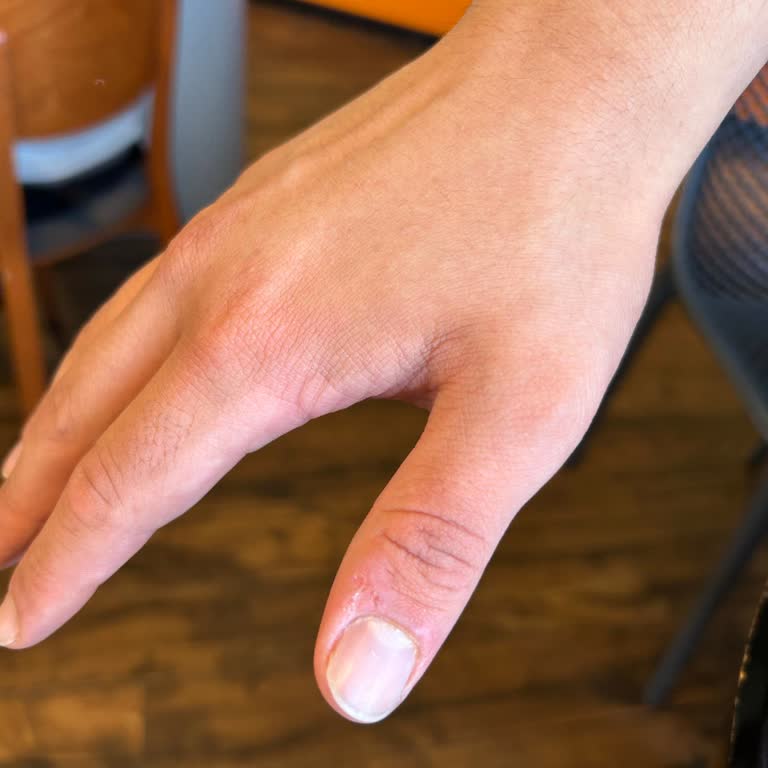 Kahvaltıda Hijyen Ve Personel İlgisizliği Hayal Kırıklığı Yarattı