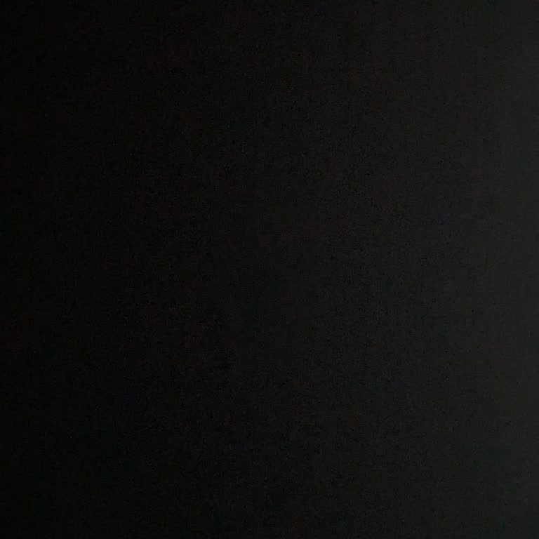 Taahhüt Edilen Kanallar Eksik Teknik Servis Ücreti İsteniyor Çözüm Sunulmuyor