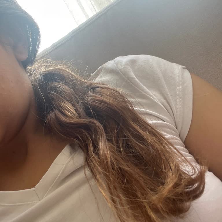 Saçlarım Öbek Öbek Dökülüyor Üründen Sonra Psikolojim Bozuldu