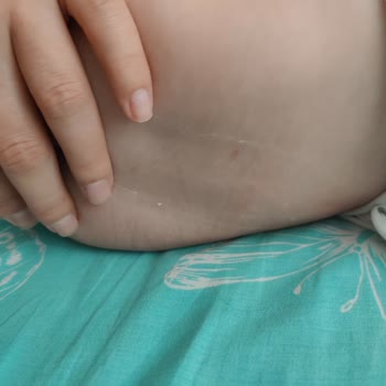 Sleepy Bebek Bezinden Çıkan Naylon İpler Bebeğimin Sağlığını Tehdit Ediyor