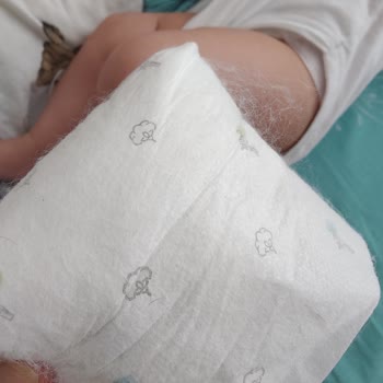 Sleepy Bebek Bezinden Çıkan Naylon İpler Bebeğimin Sağlığını Tehdit Ediyor