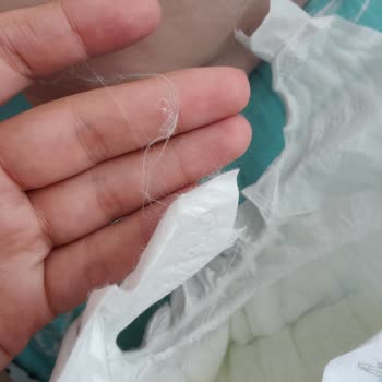 Sleepy Bebek Bezinden Çıkan Naylon İpler Bebeğimin Sağlığını Tehdit Ediyor
