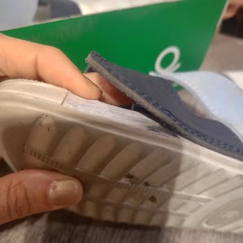 Aldığım Sandalet Birkaç Günde Deforme Oldu, Çözüm Bekliyorum