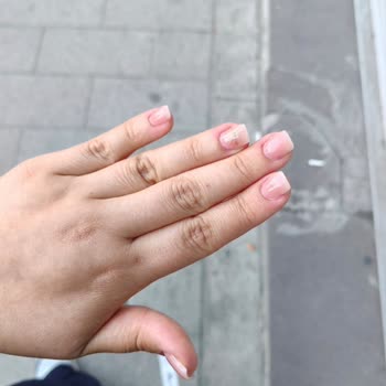 Protez Tırnak İşlemi Kısa Sürede Çıktı, Merkez Sorumluluk Almadı