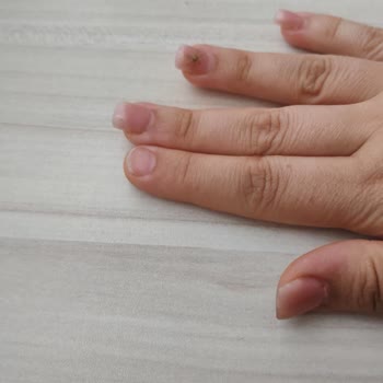 Protez Tırnak İşlemi Kısa Sürede Çıktı, Merkez Sorumluluk Almadı