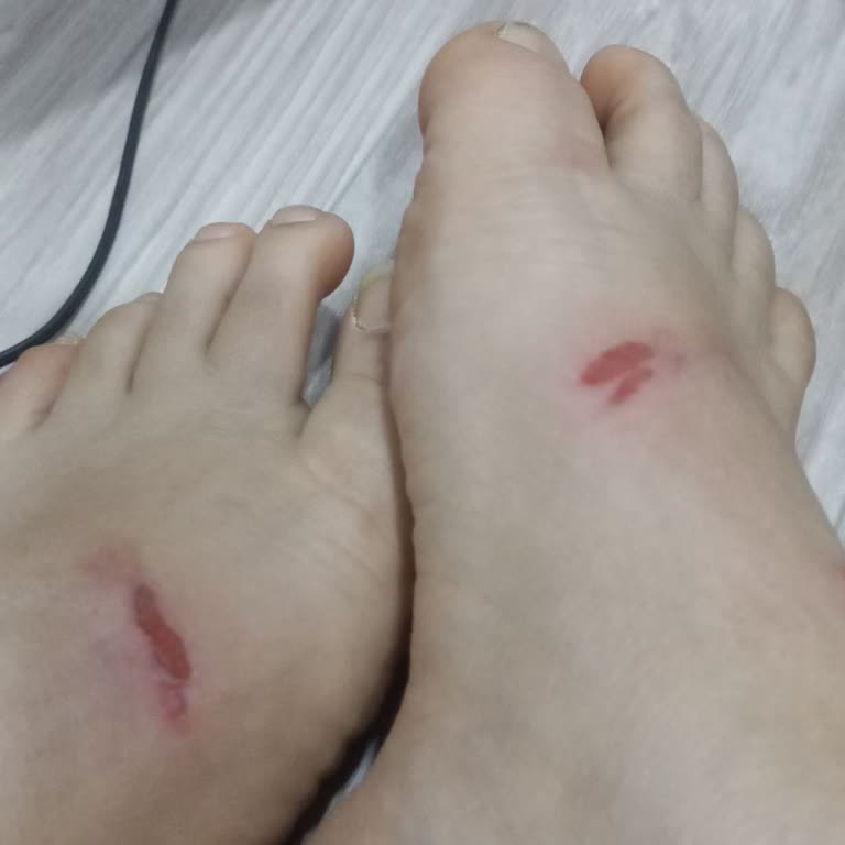 Ceyo Terlik İlk Kullanımda Ayağımı Yaraladı, Çözüm Bekliyorum