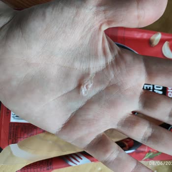 Polonez Dana Sosisin İçinden Plastik Çıkması Ve Güven Sorunu