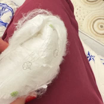 Aldığım Bebek Bezinde Beklenmedik Kalite Sorunu Yaşadım