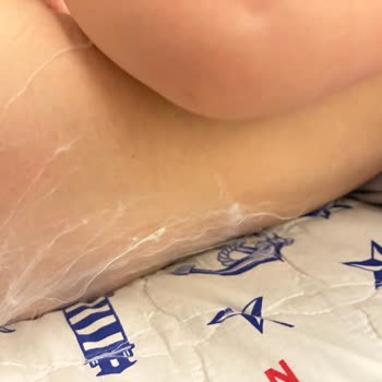 Aldığım Bebek Bezinde Beklenmedik Kalite Sorunu Yaşadım