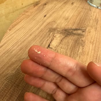 I Used La Roche-Posay Mela B3 Serum But It Peeled Off Like Eraser Bits on My Skin