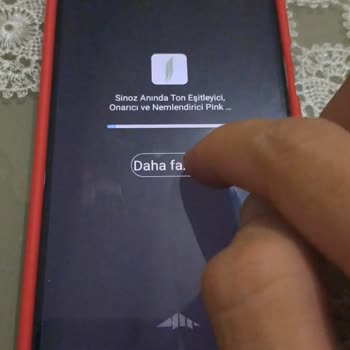 Telefonumda Sürekli Çıkan Reklamlar Ve Donma Sorunu Kullanımımı Engelliyor